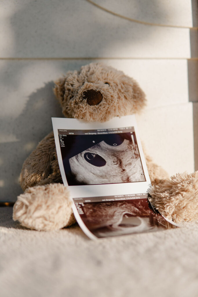 Teddybeer houdt een echo foto vast.